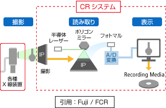 CRシステム